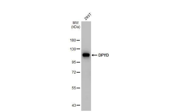 Whole cell extract (30 ug) was separated by 7.5% SDS-PAGE, and the membrane was blotted with DPYD antibody [N1N2], N-term (NBP3-48502) diluted at 1:1000. The HRP-conjugated anti-rabbit IgG antibody was used to detect the primary antibody. 
