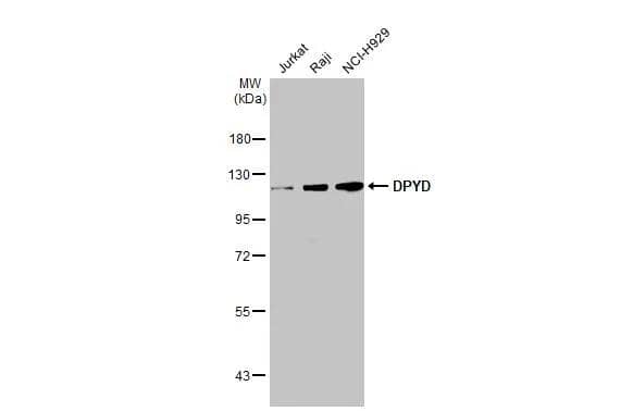 Various whole cell extracts (30 ug) were separated by 7.5% SDS-PAGE, and the membrane was blotted with DPYD antibody [N1N2], N-term (NBP3-48502) diluted at 1:1000. The HRP-conjugated anti-rabbit IgG antibody was used to detect the primary antibody. 