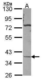 Sample (30 ug of whole cell lysate)  A: A431  10% SDS PAGE  NBP3-48503 diluted at 1:500 