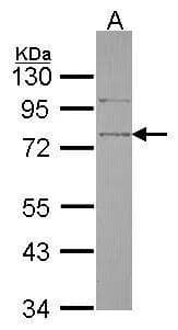 Western Blot SRPX Antibody