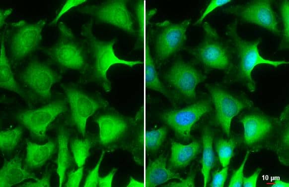 Puromycin-sensitive aminopeptidase/NPEPPS antibody [N3C2-2], Internal detects Puromycin-sensitive aminopeptidase/NPEPPS protein at cytoplasm by immunofluorescent analysis.Sample: HeLa cells were fixed in 4% paraformaldehyde at RT for 15 min.Green: Puromycin-sensitive aminopeptidase/NPEPPS stained by Puromycin-sensitive aminopeptidase/NPEPPS antibody [N3C2-2], Internal (NBP3-48506) diluted at 1:500.Blue: Fluoroshield with DAPI .Scale bar= 10 um. 