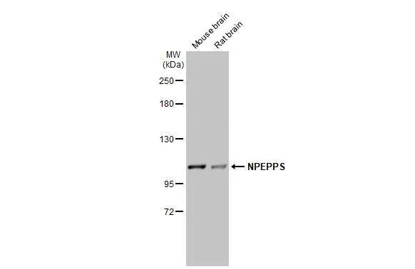 Various tissue extracts (50 ug) were separated by 5% SDS-PAGE, and the membrane was blotted with Puromycin-sensitive aminopeptidase/NPEPPS antibody [N3C2-2], Internal (NBP3-48506) diluted at 1:500. The HRP-conjugated anti-rabbit IgG antibody was used to detect the primary antibody. 