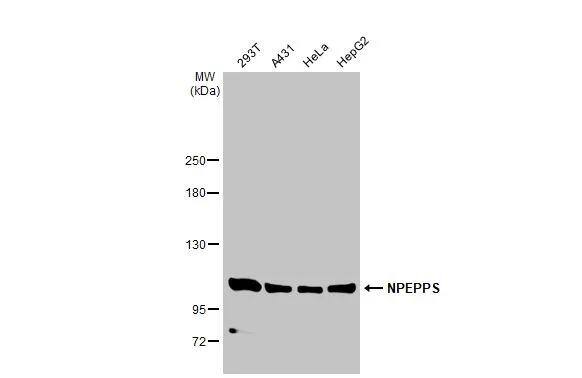 Various whole cell extracts (30 ug) were separated by 5% SDS-PAGE, and the membrane was blotted with Puromycin-sensitive aminopeptidase/NPEPPS antibody [N3C2-2], Internal (NBP3-48506) diluted at 1:1000. The HRP-conjugated anti-rabbit IgG antibody was used to detect the primary antibody. 