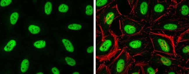 Histone H3.3B antibody detects Histone H3.3B protein at nucleus by immunofluorescent analysis.Sample: HeLa cells were fixed in 4% paraformaldehyde at RT for 15 min.Green: Histone H3.3B protein stained by Histone H3.3B antibody (NBP3-48508) diluted at 1:500.Red: Phalloidin, a cytoskeleton marker, diluted at 1:100. 