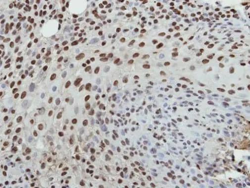 Immunohistochemical analysis of paraffin-embedded HSC3 xenograft, using Histone H3.3B(NBP3-48508) antibody at 1:500 dilution. Antigen Retrieval: (EDTA based, pH 8.0) buffer, 15min 