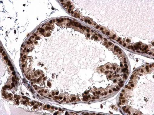 Histone H3.3B antibody detects Histone H3.3B protein at nucleus on mouse prostate by immunohistochemical analysis. Sample: Paraffin-embedded mouse prostate. Histone H3.3B antibody (NBP3-48508) dilution: 1:500. Antigen Retrieval: (EDTA based, pH 8.0) buffer, 15min 