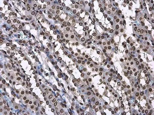 Histone H3.3B antibody detects Histone H3.3B protein at nucleus in rat kidney by immunohistochemical analysis. Sample: Paraffin-embedded rat kidney. Histone H3.3B antibody (NBP3-48508) diluted at 1:500. ^[^GTX]br>Antigen Retrieval: Citrate buffer, pH 6.0, 15 min 