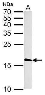 Histone H3.3B antibody detects H3F3B protein by western blot analysis.A. 50 ug rat brain lysate/extract15% SDS-PAGEHistone H3.3B antibody (NBP3-48508) dilution: 1:1000 The HRP-conjugated anti-rabbit IgG antibody was used to detect the primary antibody. 