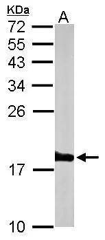 Sample (50 ug of whole cell lysate)  A: mouse brain  15% SDS PAGE  NBP3-48508 diluted at 1:1000 The HRP-conjugated anti-rabbit IgG antibody was used to detect the primary antibody. 