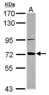 Western Blot ABCB10 Antibody