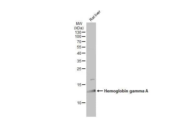 Rat tissue extract (50 ug) was separated by 15% SDS-PAGE, and the membrane was blotted with Fetal Hemoglobin antibody (NBP3-48510) diluted at 1:500. The HRP-conjugated anti-rabbit IgG antibody was used to detect the primary antibody. 