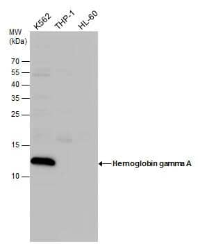 Fetal Hemoglobin antibody detects Fetal Hemoglobin protein by western blot analysis. Whole cell extracts (30 ug) was separated by 15% SDS-PAGE, and the membrane was blotted with Fetal Hemoglobin antibody (NBP3-48510) diluted at 1:500. 