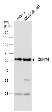 ZNHIT6 antibody detects ZNHIT6 protein by western blot analysis. Various whole cell extracts (30 ug) were separated by 10% SDS-PAGE, and the membrane was blotted with ZNHIT6 antibody (NBP3-48512) diluted by 1:1000. 