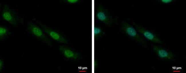 ZNF545 antibody detects ZNF545 protein at nucleus by immunofluorescent analysis.Sample: SKNSH cells were fixed in 4% paraformaldehyde at RT for 15 min.Green: ZNF545 protein stained by ZNF545 antibody (NBP3-48513) diluted at 1:500.Blue: Hoechst 33342 staining. 