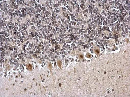 ZNF545 antibody detects ZNF545 protein at nucleus on rat hind brain by immunohistochemical analysis. Sample: Paraffin-embedded rat hind brain. ZNF545 antibody (NBP3-48513) dilution: 1:1000. Antigen Retrieval: (EDTA based, pH 8.0) buffer, 15min 