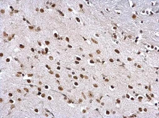 ZNF545 antibody detects ZNF545 protein at nucleus on mouse colon by immunohistochemical analysis. Sample: Paraffin-embedded mouse colon. ZNF545 antibody (NBP3-48513) dilution: 1:1000. Antigen Retrieval: (EDTA based, pH 8.0) buffer, 15min 