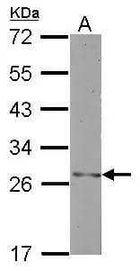 Sample (30 ug of whole cell lysate)  A: MCF-7  12% SDS PAGE  NBP3-48514 diluted at 1:2000  