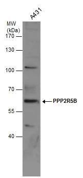 Whole cell extract (30 ug) was separated by 7.5% SDS-PAGE, and the membrane was blotted with PPP2R5B antibody (NBP3-48517) diluted at 1:1000. 