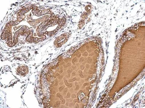 Immunohistochemistry PJA2/Praja2 Antibody