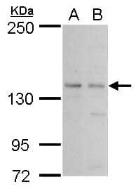 USP52 antibody detects USP52 protein by western blot analysis.A. 30 ug Jurkat whole cell lysate/extract B. 30 ug Raji whole cell lysate/extract5 % SDS-PAGEUSP52 antibody (NBP3-48521) dilution: 1:500 