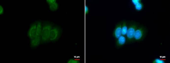 Immunocytochemistry/ Immunofluorescence DBC1 Antibody