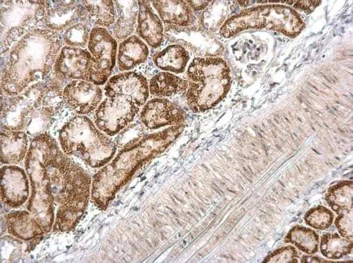 Immunohistochemistry DBC1 Antibody
