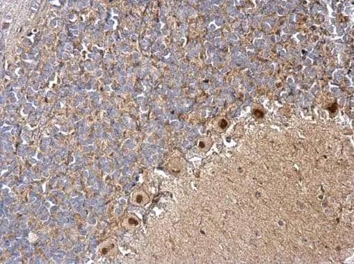 Immunohistochemistry DBC1 Antibody
