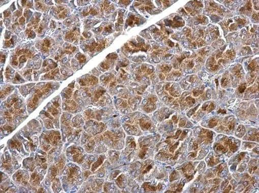 SNX25 antibody [N2C1], Internal detects SNX25 protein at cytosol on mouse pancreas by immunohistochemical analysis. Sample: Paraffin-embedded mouse pancreas. SNX25 antibody [N2C1], Internal (NBP3-48525) dilution: 1:500. Antigen Retrieval: (EDTA based, pH 8.0) buffer, 15min 