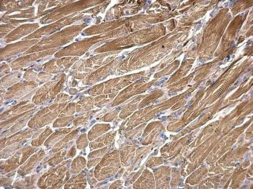 SNX25 antibody [N2C1], Internal detects SNX25 protein at cytosol on mouse muscle by immunohistochemical analysis. Sample: Paraffin-embedded mouse muscle. SNX25 antibody [N2C1], Internal (NBP3-48525) dilution: 1:500. Antigen Retrieval: (EDTA based, pH 8.0) buffer, 15min 