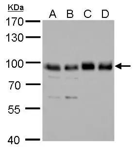 SNX25 antibody detects SNX25 protein by Western blot analysis.A. 30 ug 293T whole cell lysate/extractB. 30 ug A431 whole cell lysate/extractC. 30 ug HeLa whole cell lysate/extractD. 30 ug HepG2 whole cell lysate/extract7.5 % SDS-PAGESNX25 antibody (NBP3-48525) dilution: 1:1000 