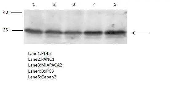 <b>Genetic Strategies Validation. </b>Prostaglandin reductase 1 antibody [N1C2] detects Prostaglandin reductase 1 protein by Western blot analysis.A. 40 ?g PL45 whole cell lysate/extractB. 40 ?g PANC1 whole cell lysate/extract C. 40 ?g MIAPACA2 whole cell lysate/extract D. 40 ?g BxPC3 whole cell lysate/extract E. 40 ?g Capan2 whole cell lysate/extractProstaglandin reductase 1 antibody [N1C2] (NBP3-48527) dilution: 1:500 