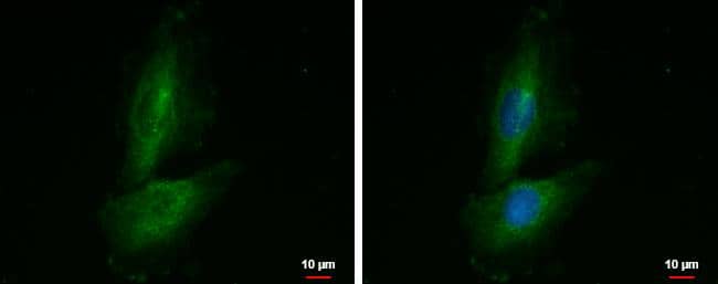 Proline rich 16 antibody detects Proline rich 16 protein at cytoplasm and nucleus by immunofluorescent analysis.Sample: SKNSH cells were fixed in 4% paraformaldehyde at RT for 15 min.Green: Proline rich 16 protein stained by Proline rich 16 antibody (NBP3-48528) diluted at 1:500.Blue: Hoechst 33342 staining. 