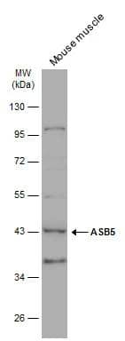 Mouse tissue extract (50 ug) was separated by 10% SDS-PAGE, and the membrane was blotted with ASB5 antibody (NBP3-48530) diluted at 1:3000. The HRP-conjugated anti-rabbit IgG antibody was used to detect the primary antibody. 