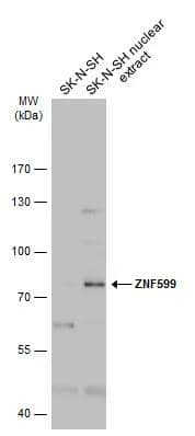 <b>Orthogonal Strategies Validation. </b>SK-N-SH whole cell and nuclear extracts (30 ug) were separated by 7.5% SDS-PAGE, and the membrane was blotted with ZNF599 antibody (NBP3-48531) diluted at 1:2000. The HRP-conjugated anti-rabbit IgG antibody was used to detect the primary antibody. 