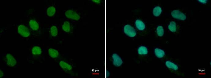 MEF2B antibody detects MEF2B protein at nucleus by immunofluorescent analysis.Sample: NT2D1 cells were fixed in 4% paraformaldehyde at RT for 15 min.Green: MEF2B protein stained by MEF2B antibody (NBP3-48532) diluted at 1:500.Blue: Hoechst 33342 staining. 