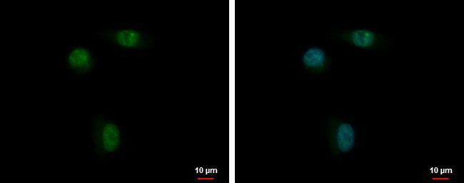 ANKRD23 antibody detects ANKRD23 protein at nucleus by immunofluorescent analysis.Sample: PC-3 cells were fixed in 4% paraformaldehyde at RT for 15 min.Green: ANKRD23 protein stained by ANKRD23 antibody (NBP3-48533) diluted at 1:500.Blue: Hoechst 33342 staining. 