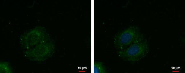 METTL19 antibody detects METTL19 protein at cytoplasm by immunofluorescent analysis.Sample: NT2D1 cells were fixed in ice-cold MeOH for 5 min.Green: METTL19 protein stained by METTL19 antibody (NBP3-48536) diluted at 1:500.Blue: Hoechst 33342 staining. 