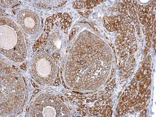 Immunohistochemistry SYTL4 Antibody