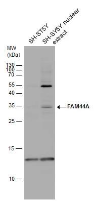 BOD1L antibody detects BOD1L protein by western blot analysis. SH-SY5Y whole cell extracts and nuclear extracts (30 ?g) were separated by 15% SDS-PAGE, and the membrane was blotted with BOD1L antibody (NBP3-48538) diluted by 1:1000. 