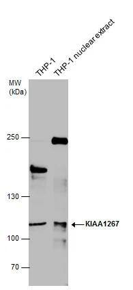 KANSL1 antibody detects KANSL1 protein by western blot analysis. THP-1 whole cell extracts and extracts (30 ug) were separated by 5% SDS-PAGE, and the membrane was blotted with KANSL1 antibody (NBP3-48539) diluted at 1:500. 