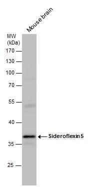 SFXN5 antibody detects SFXN5 protein by western blot analysis. Mouse tissue extracts (50 ug) was separated by 10 % SDS-PAGE, and the membrane was blotted with SFXN5 antibody (NBP3-48541) diluted by 1:1000. 