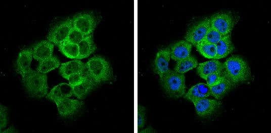 AMOTL2 antibody [C1C3] detects AMOTL2 protein at cytoplasm by immunofluorescent analysis.Sample: A431 cells were fixed in 4% paraformaldehyde at RT for 15 min.Green: AMOTL2 protein stained by AMOTL2 antibody [C1C3] (NBP3-48542) diluted at 1:500.Blue: Hoechst 33342 staining. 