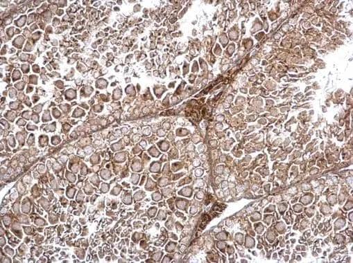 Immunohistochemistry TRAPPC2L Antibody