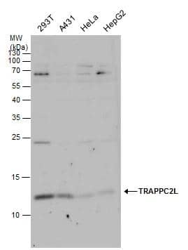 Western Blot TRAPPC2L Antibody