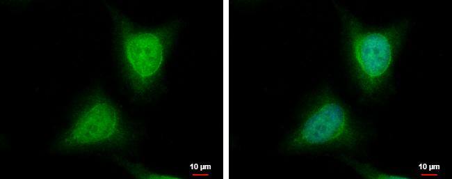 wdyhv1 antibody detects wdyhv1 protein at cytoplasm and nucleus by immunofluorescent analysis.Sample: HeLa cells were fixed in 4% paraformaldehyde at RT for 15 min.Green: wdyhv1 protein stained by wdyhv1 antibody (NBP3-48548) diluted at 1:200.Blue: Hoechst 33342 staining. 
