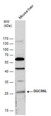 Western Blot DGCR6L Antibody