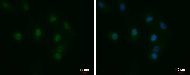 LCMT1 antibody detects LCMT1 protein at nucleus by immunofluorescent analysis. Sample: A549 cells were fixed in 4% paraformaldehyde/PBS for 15 min.Green: LCMT1 protein stained by LCMT1 antibody (NBP3-48555) diluted at 1:500.Blue: Hoechst 33342 staining. 