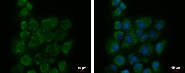 Immunocytochemistry/ Immunofluorescence BZW1 Antibody