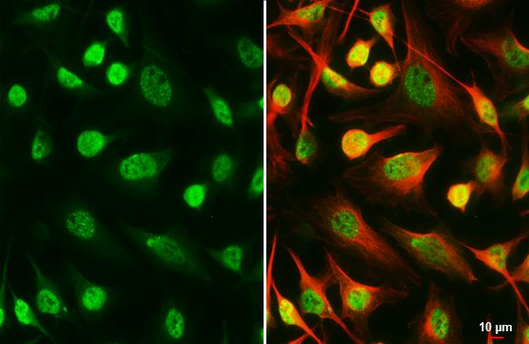 SETDB1 antibody [HL3260] detects SETDB1 protein by immunofluorescent analysis.Sample: HeLa cells were fixed in 4% paraformaldehyde at RT for 15 min.Green: SETDB1 stained by SETDB1 antibody [HL3260] (NBP3-48557) diluted at 1:500.Red: alpha Tubulin, a cytoskeleton marker, stained by alpha Tubulin antibody [GT114] diluted at 1:1000. 