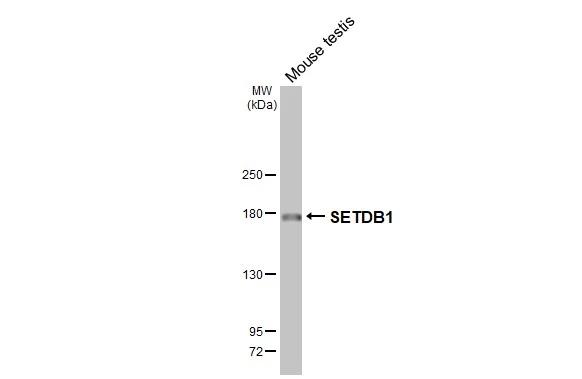 Mouse tissue extract (50 ug) was separated by 5% SDS-PAGE, and the membrane was blotted with SETDB1 antibody [HL3260] (NBP3-48557) diluted at 1:1000. The HRP-conjugated anti-rabbit IgG antibody was used to detect the primary antibody. 